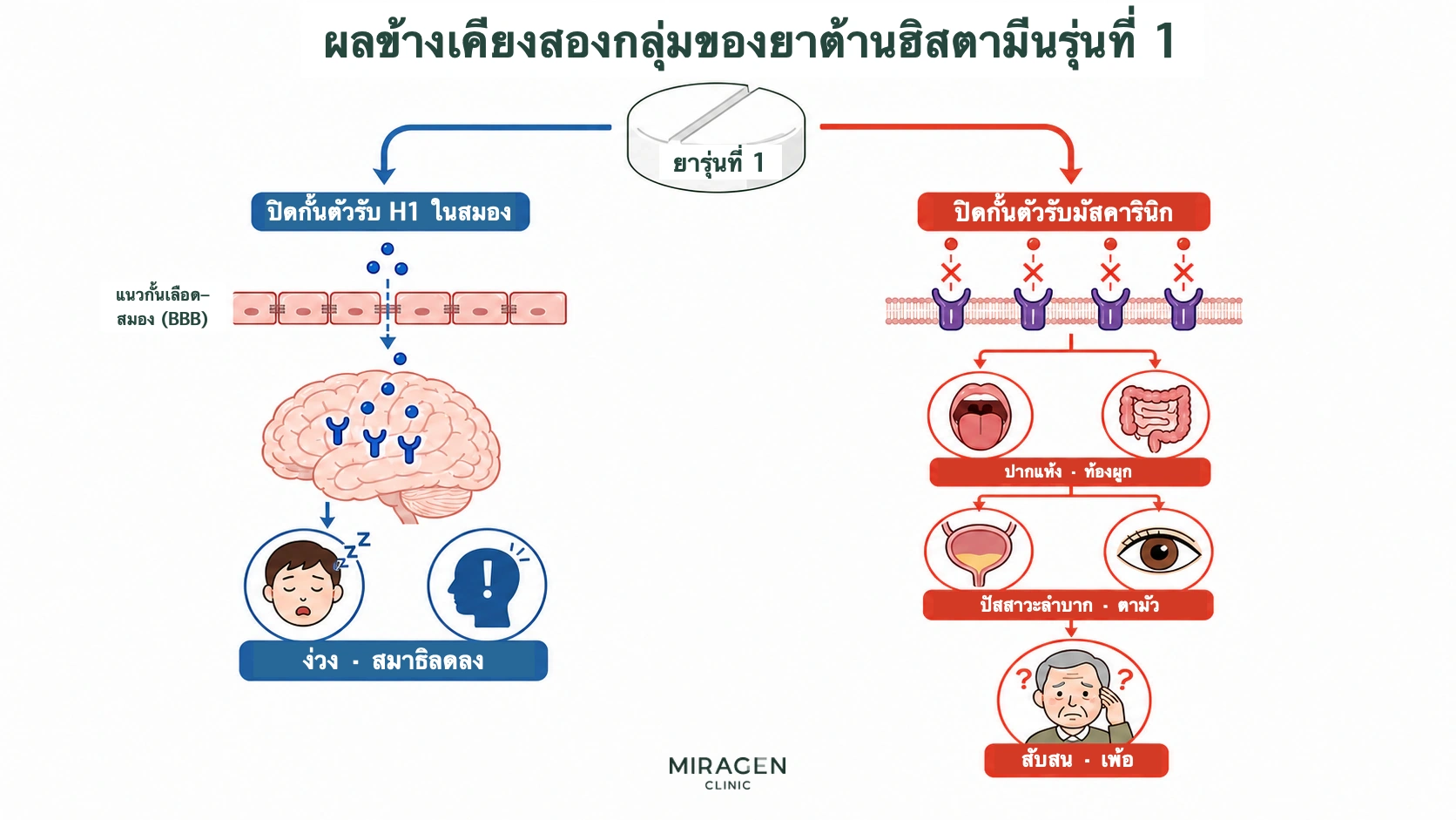 ภาพเปรียบเทียบสองเส้นทางของผลข้างเคียงยาต้านฮิสตามีนรุ่นที่ 1 ได้แก่ การปิดกั้น H1 ในสมองจนง่วงและสมาธิลด กับการปิดกั้นตัวรับมัสคารินิกจนปากแห้ง ท้องผูก ปัสสาวะลำบาก ตาพร่า สับสน และเพ้อ