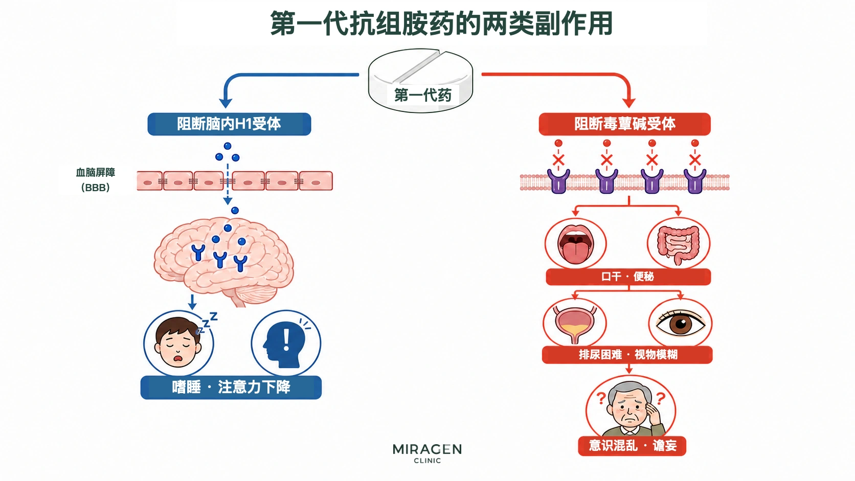 示意图：第一代抗组胺药阻断大脑 H1 受体后引起困倦和注意力下降；阻断毒蕈碱受体后引起口干、便秘、排尿困难、视物模糊、意识混乱和谵妄