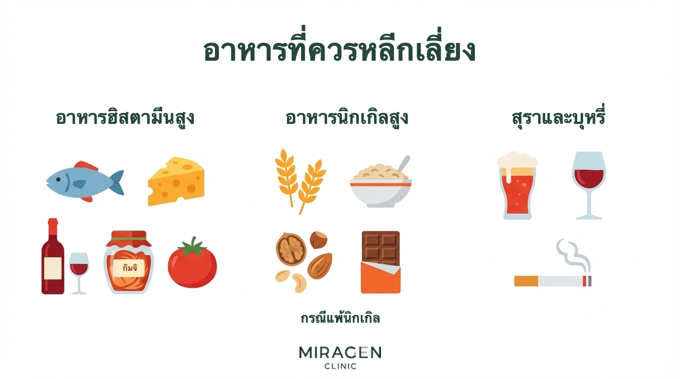 ภาพจัดอาหารและปัจจัยที่ควรเลี่ยงเมื่อมีผื่นภูมิแพ้ผิวหนังเป็นสามกลุ่ม ได้แก่ อาหารฮิสตามีนสูง อาหารนิกเกิลสูง และแอลกอฮอล์กับบุหรี่