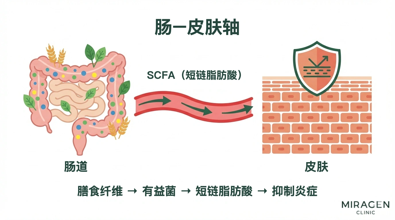 信息图分步骤展示益生菌与膳食纤维经肠道菌群产生短链脂肪酸,进而抑制全身炎症并帮助维持皮肤屏障的肠道-皮肤机制
