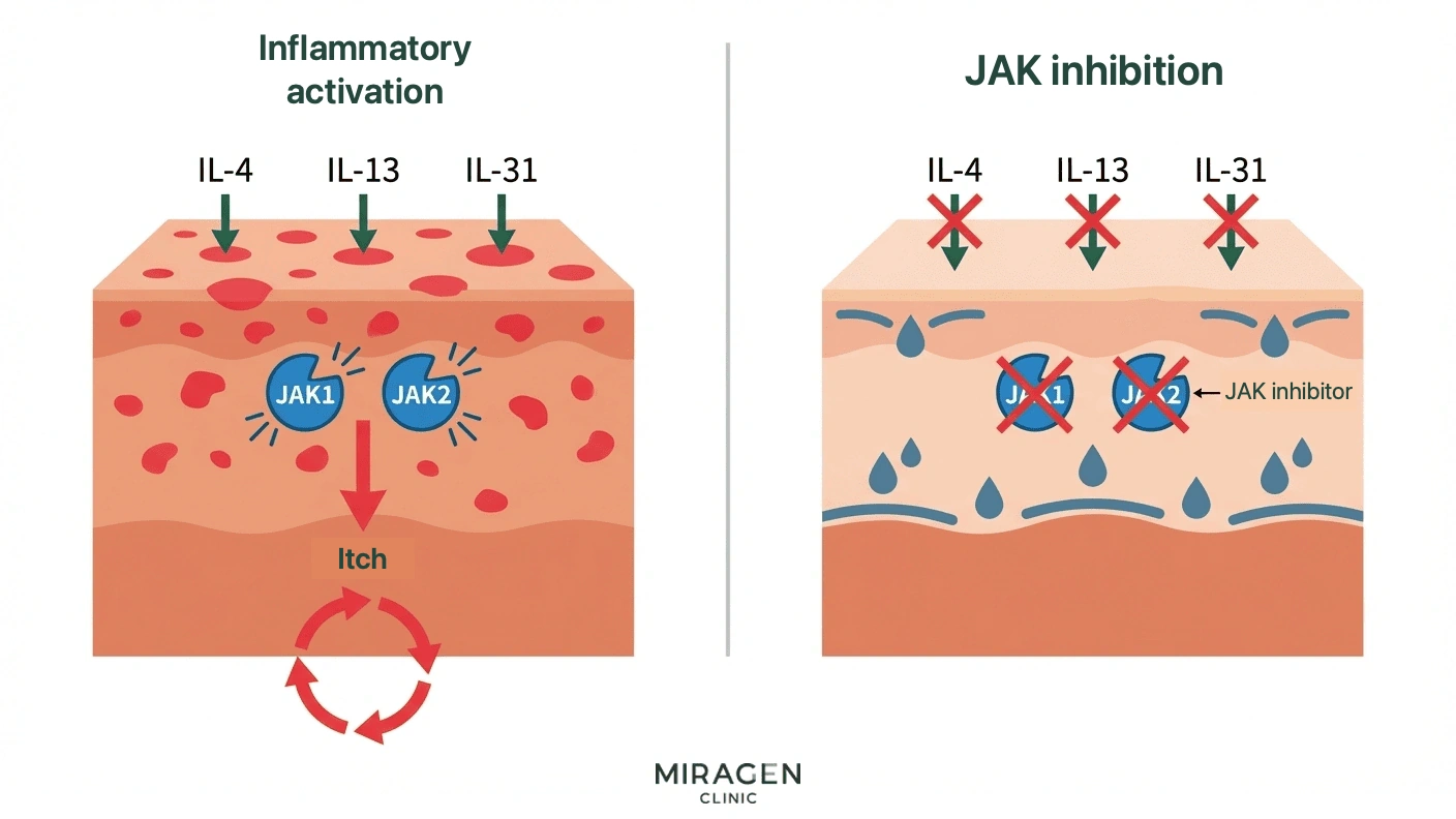 A medical illustration showing the mechanism of action where ruxolitinib, the main ingredient in Rutinib ointment and Opzelura, inhibits JAK1 and JAK2 to block atopic itching and inflammatory signals.