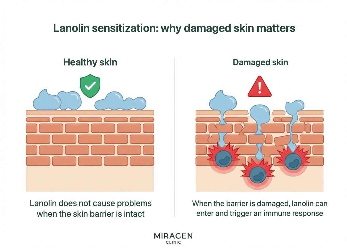 A cross-sectional illustration of the skin barrier comparing the mechanism of lanolin sensitization in healthy skin and damaged skin — lanolin cannot penetrate if the barrier is intact, but triggers an immune response if it is damaged