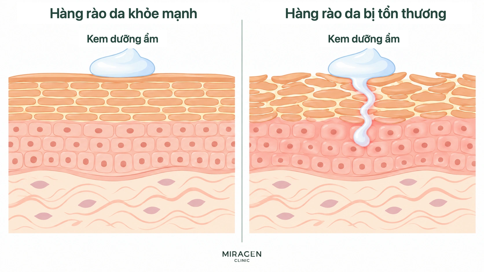 Hình so sánh dưỡng ẩm lưu lại trên bề mặt hàng rào da khỏe với một phần thành phần thấm sâu khi hàng rào tổn thương