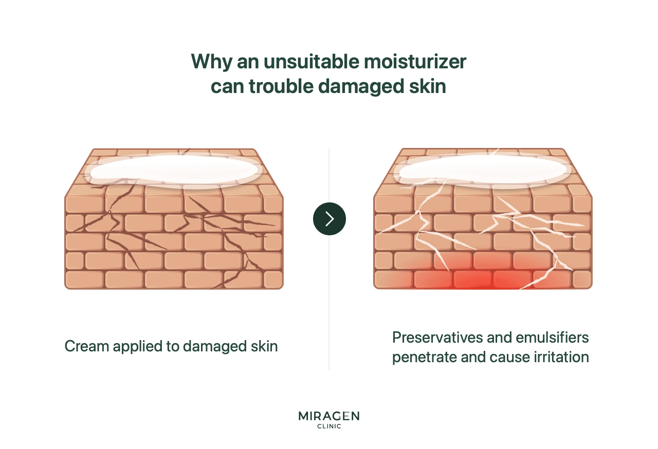 Infographic explaining how applying an unsuitable moisturizer to damaged skin causes preservatives and emulsifiers to excessively penetrate through cracks in the brick wall structure, worsening irritation and inflammation