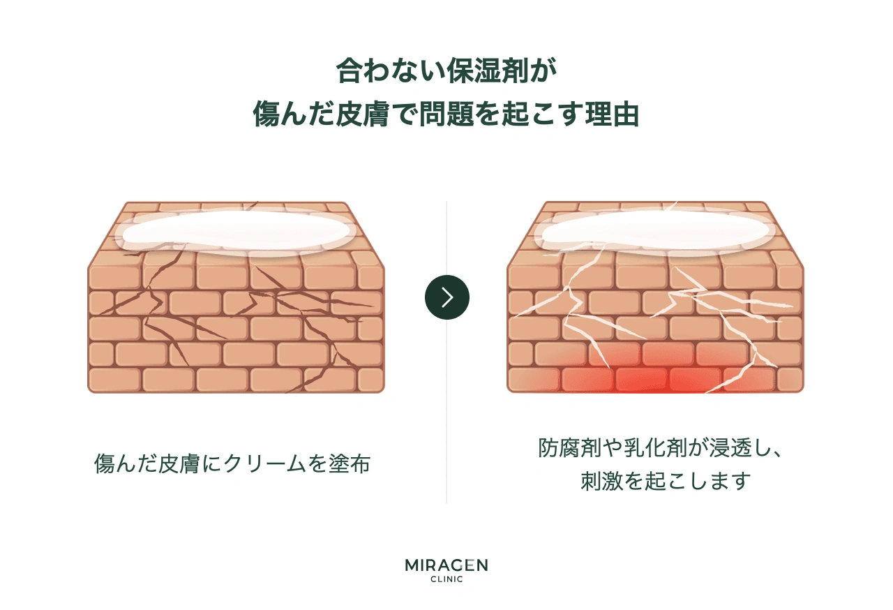 損傷した皮膚バリアに合わない保湿剤を塗ると、防腐剤や乳化剤がレンガの壁の亀裂から過剰に浸透し、刺激と炎症をかえって悪化させる過程を説明するインフォグラフィック
