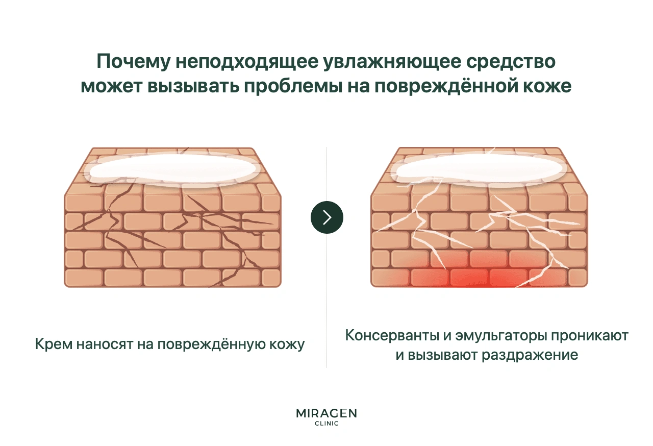 Инфографика показывает, как консерванты и эмульгаторы неподходящего крема чрезмерно проникают через трещины повреждённого кожного барьера и усиливают раздражение и воспаление