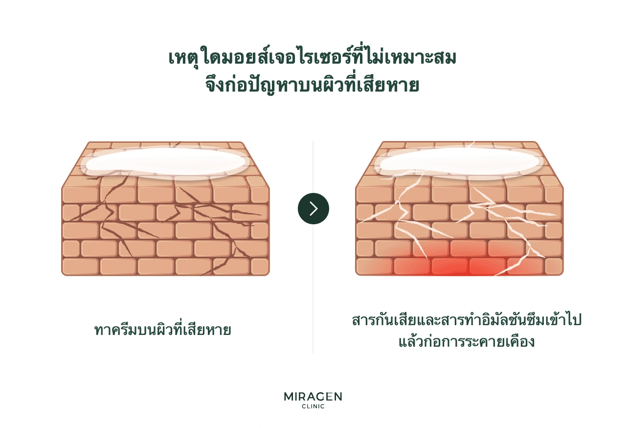 อินโฟกราฟิกแสดงสารกันเสียและสารทำอิมัลชันจากมอยส์เจอไรเซอร์ที่ไม่เหมาะ ซึมผ่านรอยแตกของเกราะป้องกันผิวที่เสียหายมากเกินไปจนทำให้ระคายเคืองและอักเสบหนักขึ้น