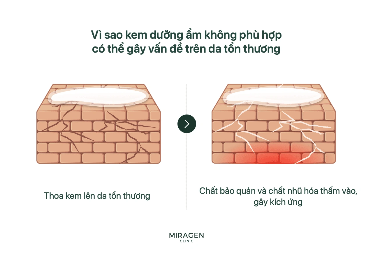 Đồ họa cho thấy khi bôi kem dưỡng ẩm không phù hợp lên hàng rào da tổn thương, chất bảo quản và chất nhũ hóa đi quá nhiều qua khe nứt trong tường gạch, làm kích thích và viêm nặng hơn