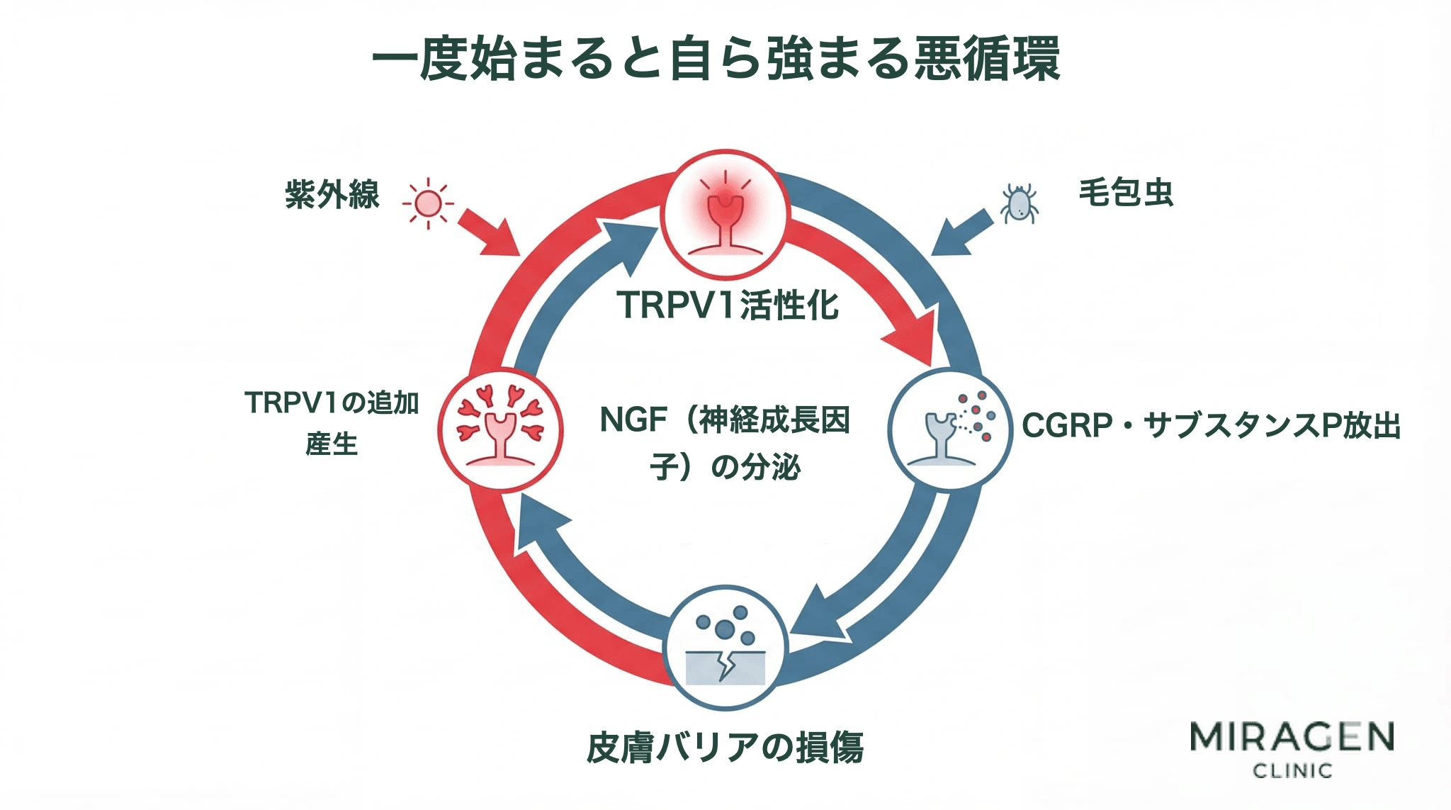 TRPV1悪循環の過程を示す循環ダイアグラム。TRPV1活性化からCGRPとサブスタンスPの放出、NGF分泌、TRPV1の追加生成へと続く自己強化ループと、紫外線、ニキビダニ、皮膚バリア損傷がこの循環を誘発する過程を図式化。 