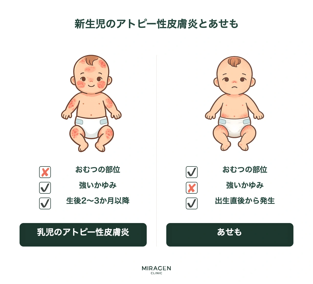 新生児アトピーの症状と乳児湿疹(胎熱)を、かゆみ・おむつ部位・発症時期の基準で比較したインフォグラフィックで、3つの鑑別基準をひと目で整理