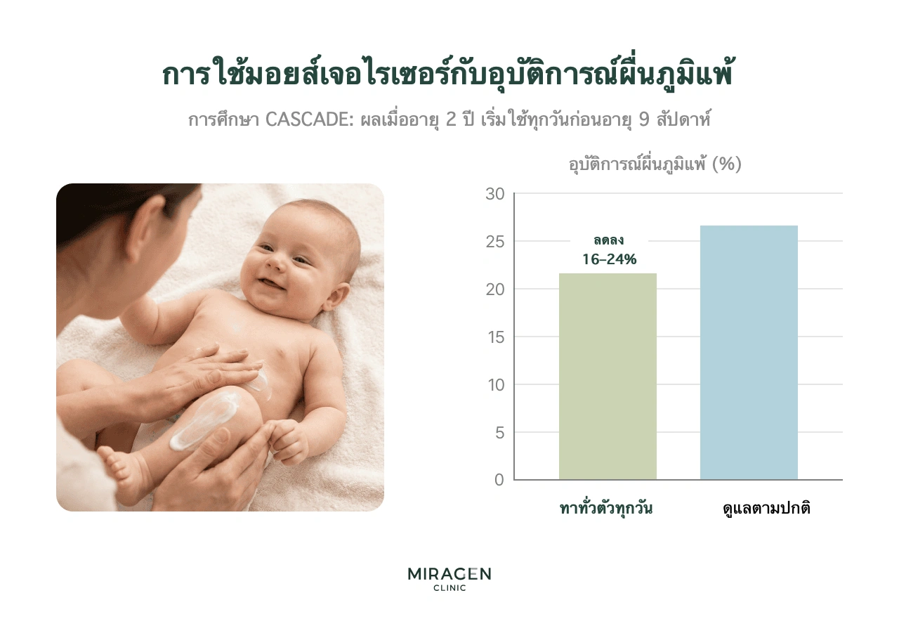 อินโฟกราฟิกผลการทดลอง CASCADE แสดงการทามอยส์เจอไรเซอร์ทั่วตัวทุกวันก่อนอายุ 9 สัปดาห์ ลดอัตราผื่นภูมิแพ้ผิวหนังเมื่ออายุ 2 ปีลง 16–24% เทียบกับการดูแลทั่วไป