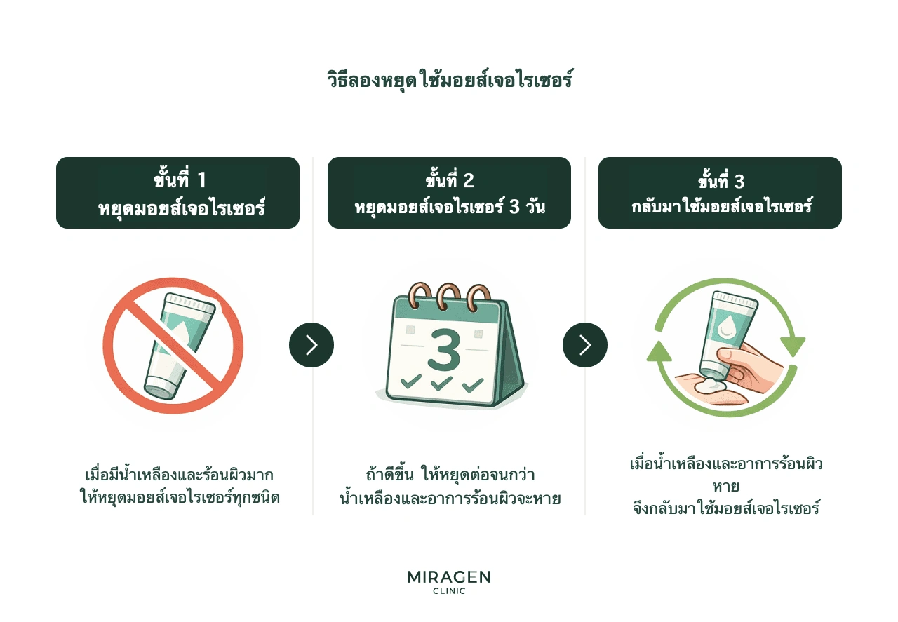 อินโฟกราฟิกสามขั้นตอนของการหยุดใช้มอยส์เจอไรเซอร์: หยุดเมื่อมีน้ำเหลืองซึมหรือร้อนผิวมาก สังเกตอาการ และกลับมาใช้เมื่อเริ่มแห้ง
