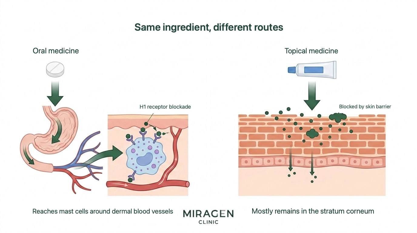 Illustration comparing pathways in a left-right split: oral antihistamines pass through the digestive tract to reach and act on H1 receptors on dermal mast cells, while topical antihistamines are blocked by the stratum corneum barrier and remain mostly in the epidermis