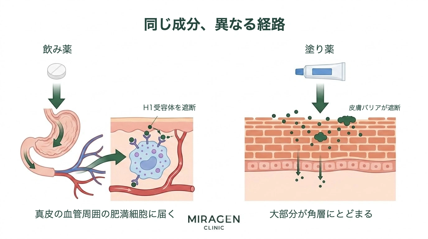 内服の抗ヒスタミン薬は消化管を経て真皮の肥満細胞H1受容体まで到達して作用し、外用の抗ヒスタミン薬は角質層バリアに阻まれて表皮に大半がとどまる――その経路の違いを左右分割で比較したイラスト
