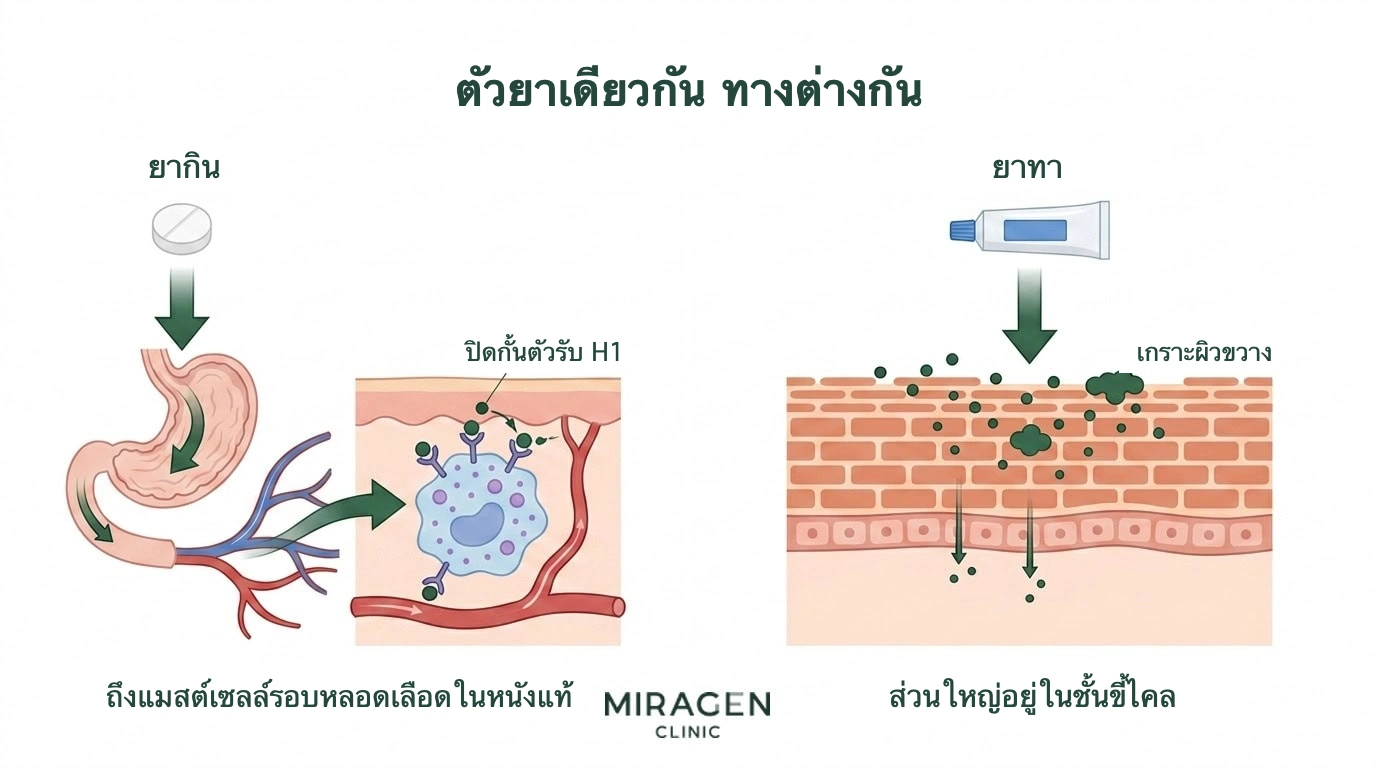 ภาพเปรียบเทียบเส้นทางยาต้านฮิสตามีนชนิดกินที่ผ่านทางเดินอาหารและเลือดไปถึงตัวรับ H1 ในผิวลึก กับยาทาที่ส่วนใหญ่ติดอยู่ที่ผิวชั้นนอกเพราะเกราะผิว