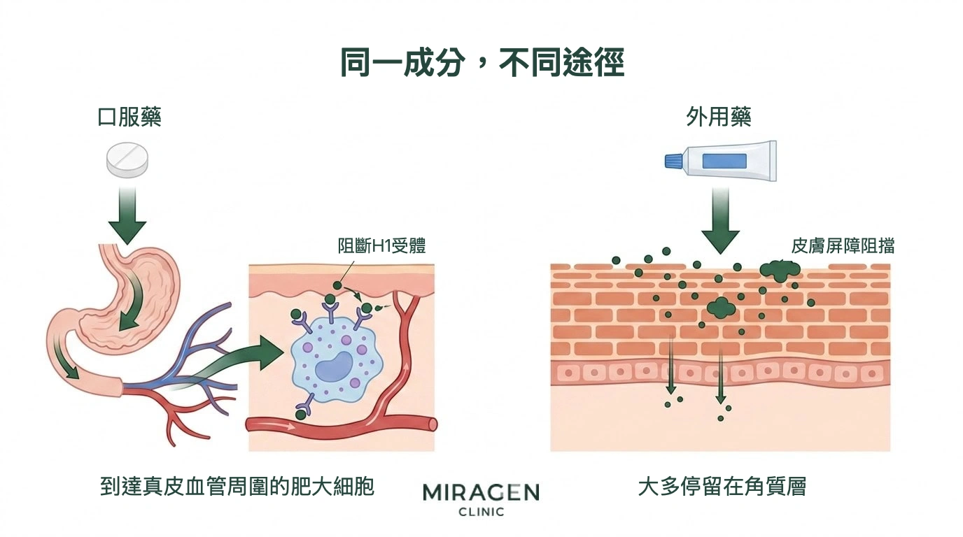 左右分欄的插圖比較給藥路徑：口服抗組織胺藥經過消化道，到達真皮中肥大細胞的 H1 受體並發揮作用；外用抗組織胺藥受到角質層屏障阻擋，大多停留在表皮