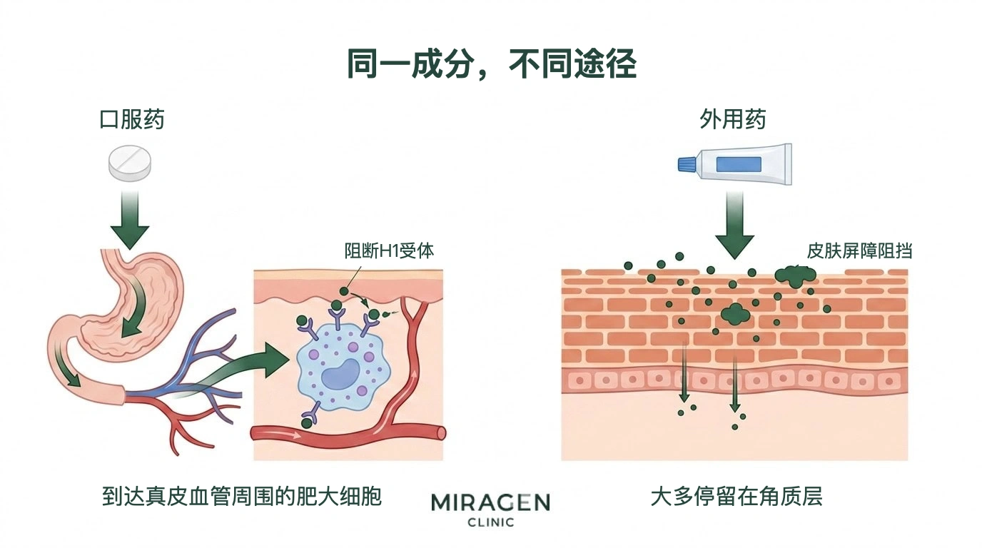 左右分栏的插图比较给药路径：口服抗组胺药经过消化道，到达真皮中肥大细胞的 H1 受体并发挥作用；外用抗组胺药受到角质层屏障阻挡，大多停留在表皮