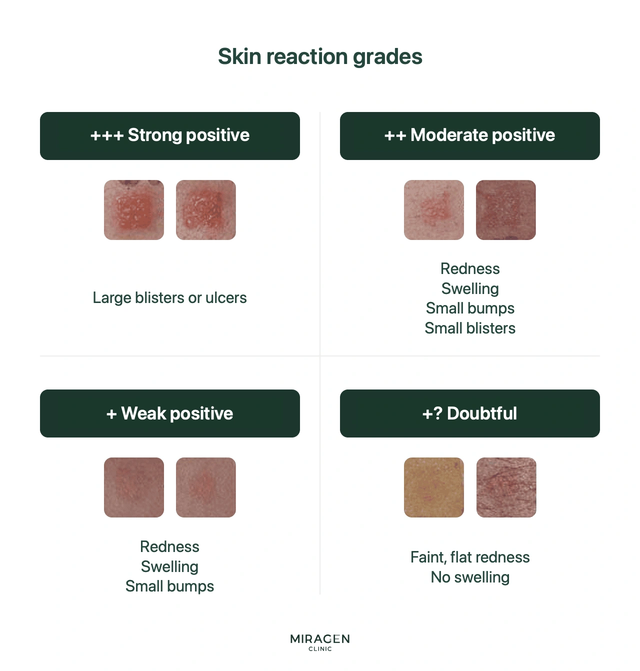 Patch Test Result Interpretation Table — An infographic classifying grades as Negative (−), Doubtful (±), or Positive (+ to +++) based on reaction intensity.