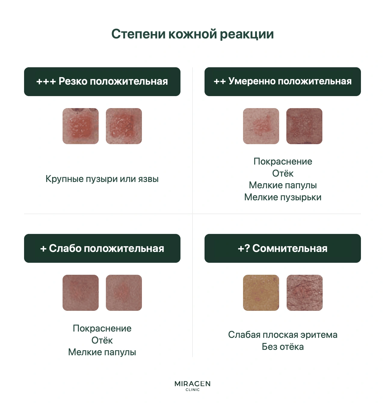 Таблица оценки патч-теста: отрицательная реакция −, сомнительная ± и положительные реакции от + до +++ в зависимости от выраженности