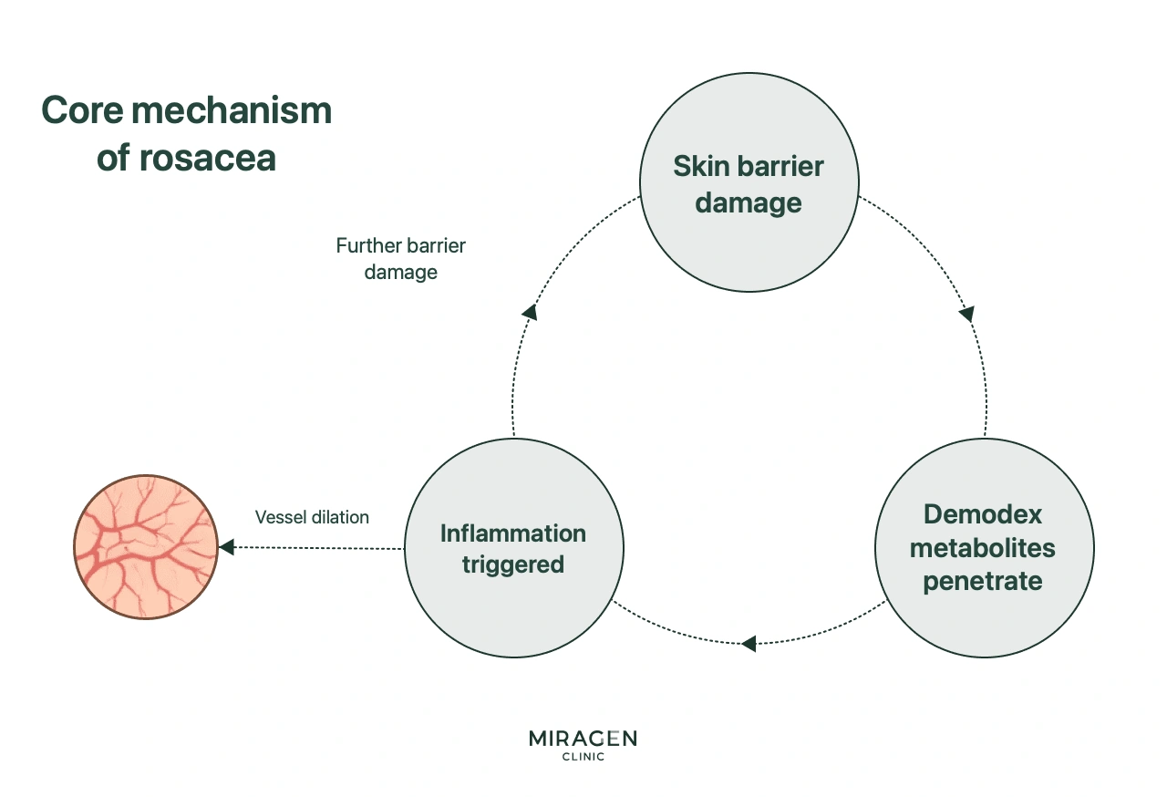 A cycle diagram showing the core mechanism of rosacea: damaged skin barrier leads to vascular dilation and penetration of Demodex byproducts, which triggers inflammation, further damaging the barrier in a vicious cycle.