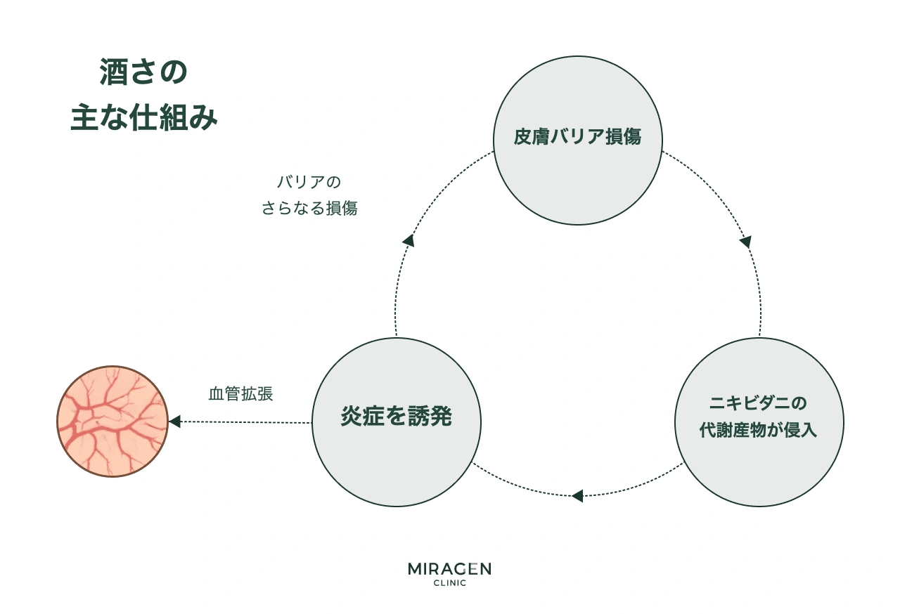 酒さの核心メカニズムを示す循環ダイアグラムで、皮膚バリアが損傷すると血管が拡張し、毛包虫の副産物が浸透して炎症が誘発され、その炎症が再びバリアを損傷させる悪循環の構造を示しています。