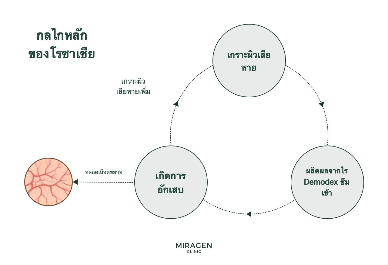 แผนภาพวงจรโรซาเซีย แสดงเกราะป้องกันผิวเสียหาย หลอดเลือดขยาย ผลผลิตจากไรเดโมเด็กซ์ซึมผ่าน กระตุ้นการอักเสบ แล้วทำให้เกราะเสียหายเพิ่ม