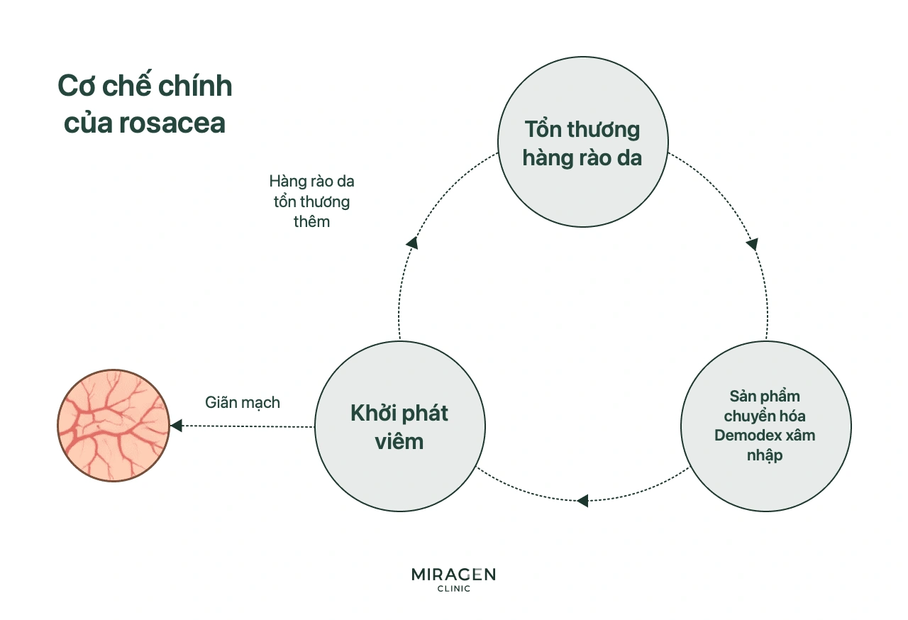 Sơ đồ vòng luẩn quẩn: hàng rào da tổn thương, mạch giãn, sản phẩm từ Demodex xâm nhập gây viêm và viêm tiếp tục làm hỏng hàng rào