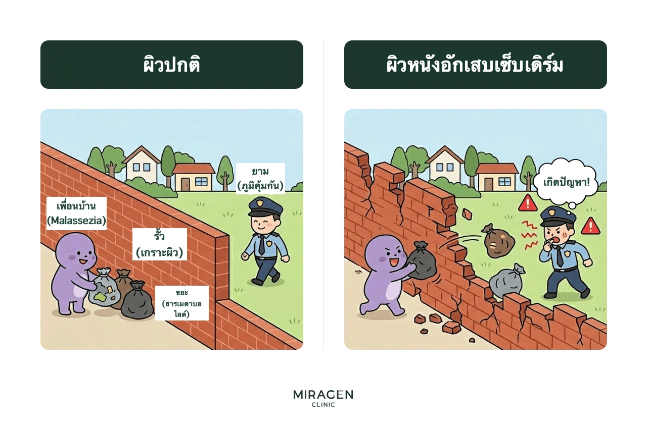 อินโฟกราฟิกเปรียบเทียบกำแพงแข็งแรงที่กันขยะของเพื่อนบ้านบนผิวปกติ กับกำแพงพังที่เกิดความขัดแย้งกับเจ้าหน้าที่รักษาความปลอดภัย เปรียบกับเกราะผิว มาลาสซีเซีย และภูมิคุ้มกัน