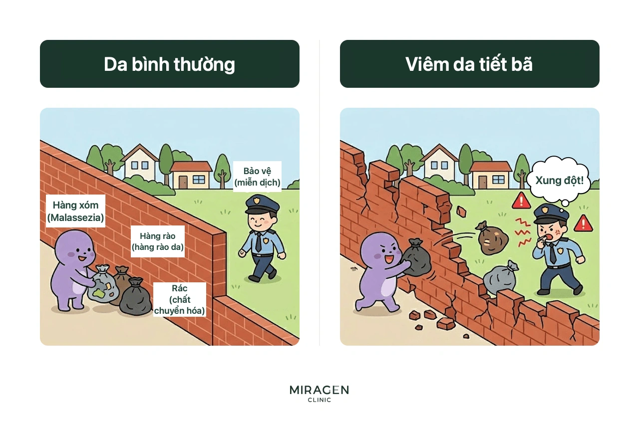 Hình ví von hàng rào da khỏe như bức tường ngăn rác bên ngoài, còn hàng rào hỏng dẫn đến phản ứng miễn dịch với Malassezia