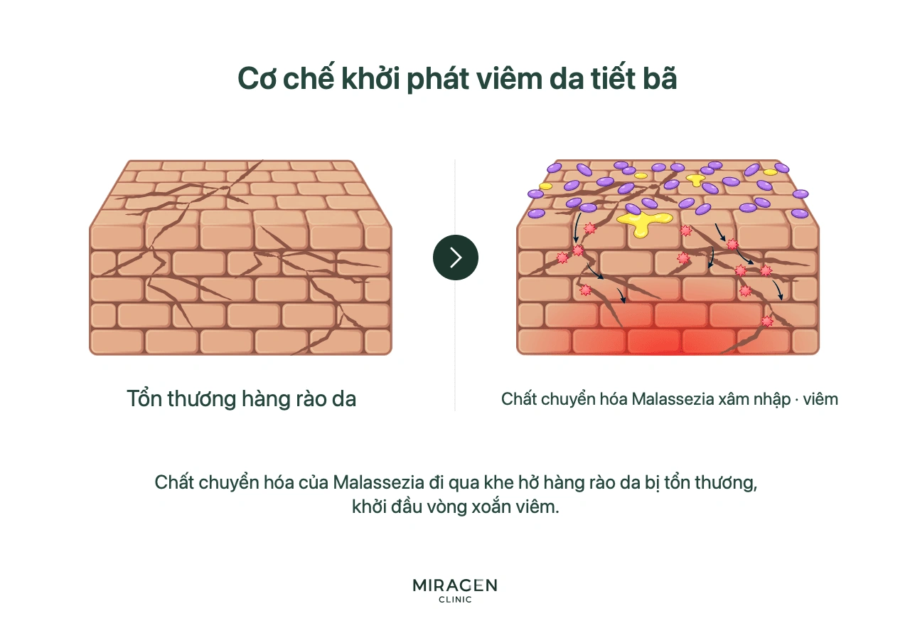 Sơ đồ từng bước vòng luẩn quẩn khi sản phẩm chuyển hóa của Malassezia đi qua hàng rào da tổn thương, gây viêm rồi làm hàng rào tổn thương thêm