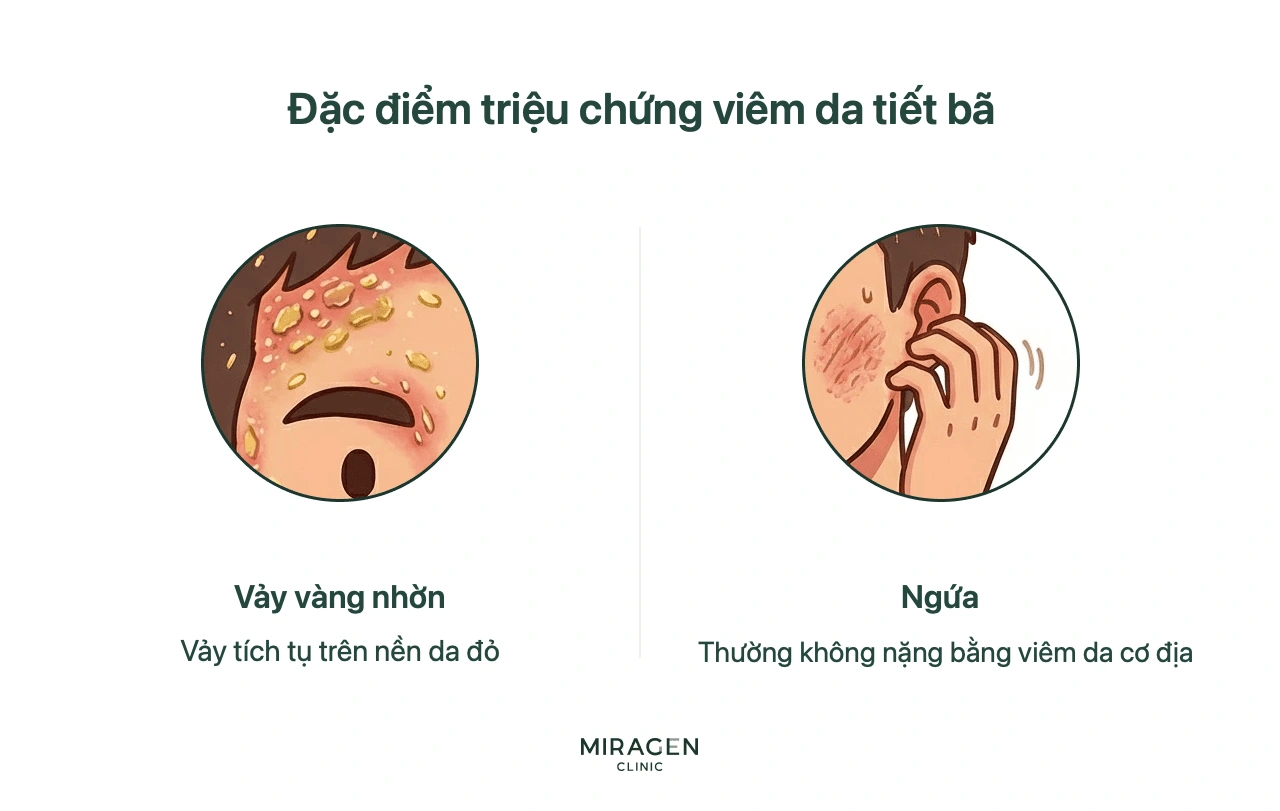 Hai triệu chứng điển hình của viêm da tiết bã: vảy vàng nhờn trên da đỏ và ngứa thường nhẹ hơn viêm da cơ địa