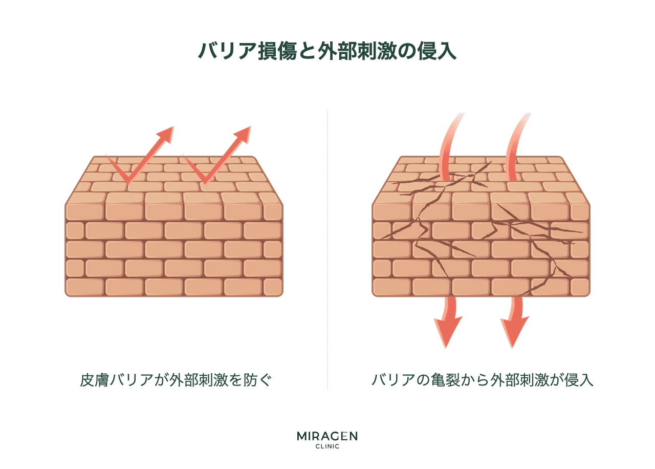 正常な皮膚バリアでは外部刺激がはね返され、損傷したバリアでは隙間から通り抜ける様子