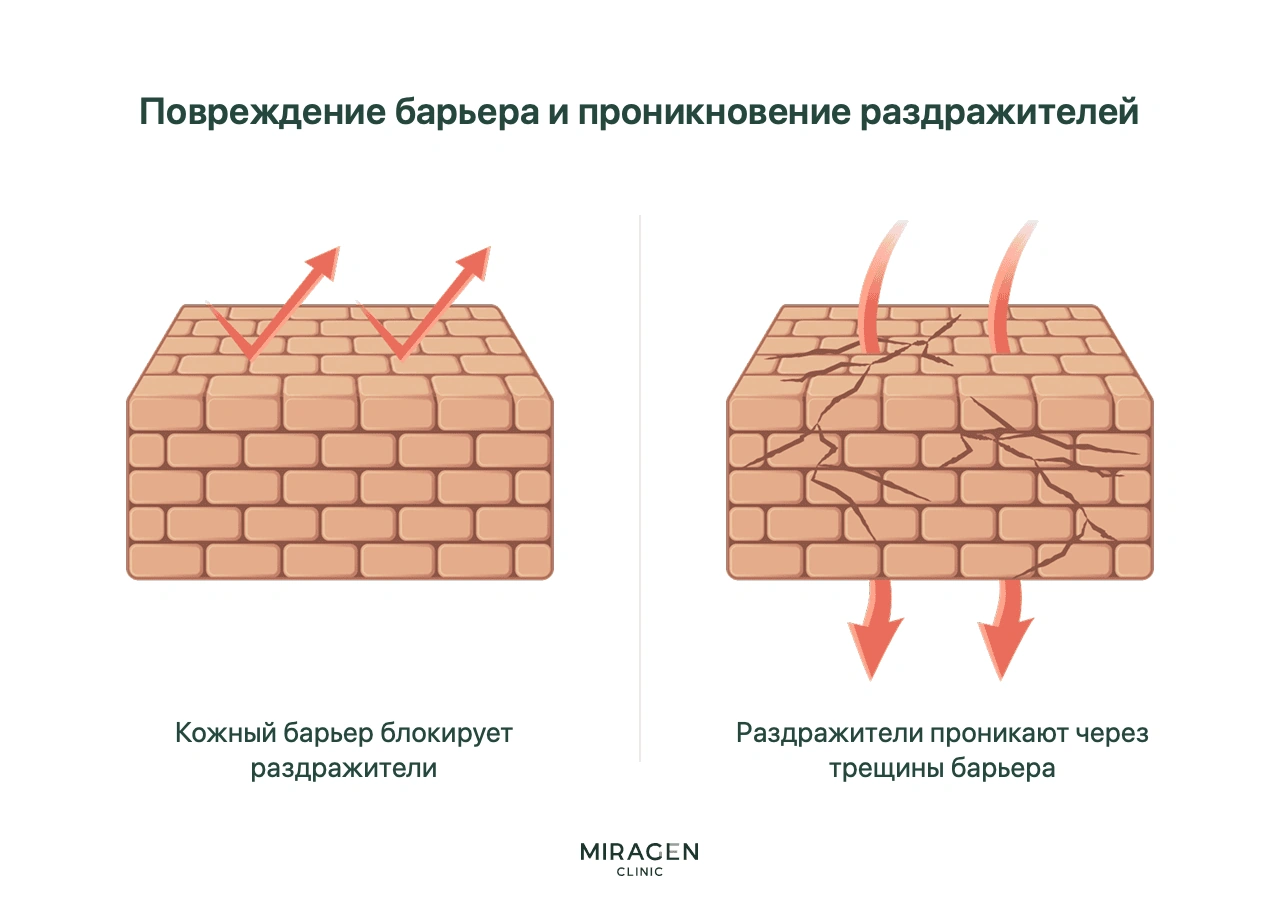 Объяснение нарушения кожного барьера через сравнение с кирпичной стеной: целый барьер задерживает внешние раздражители, а через трещины повреждённого они проникают в кожу