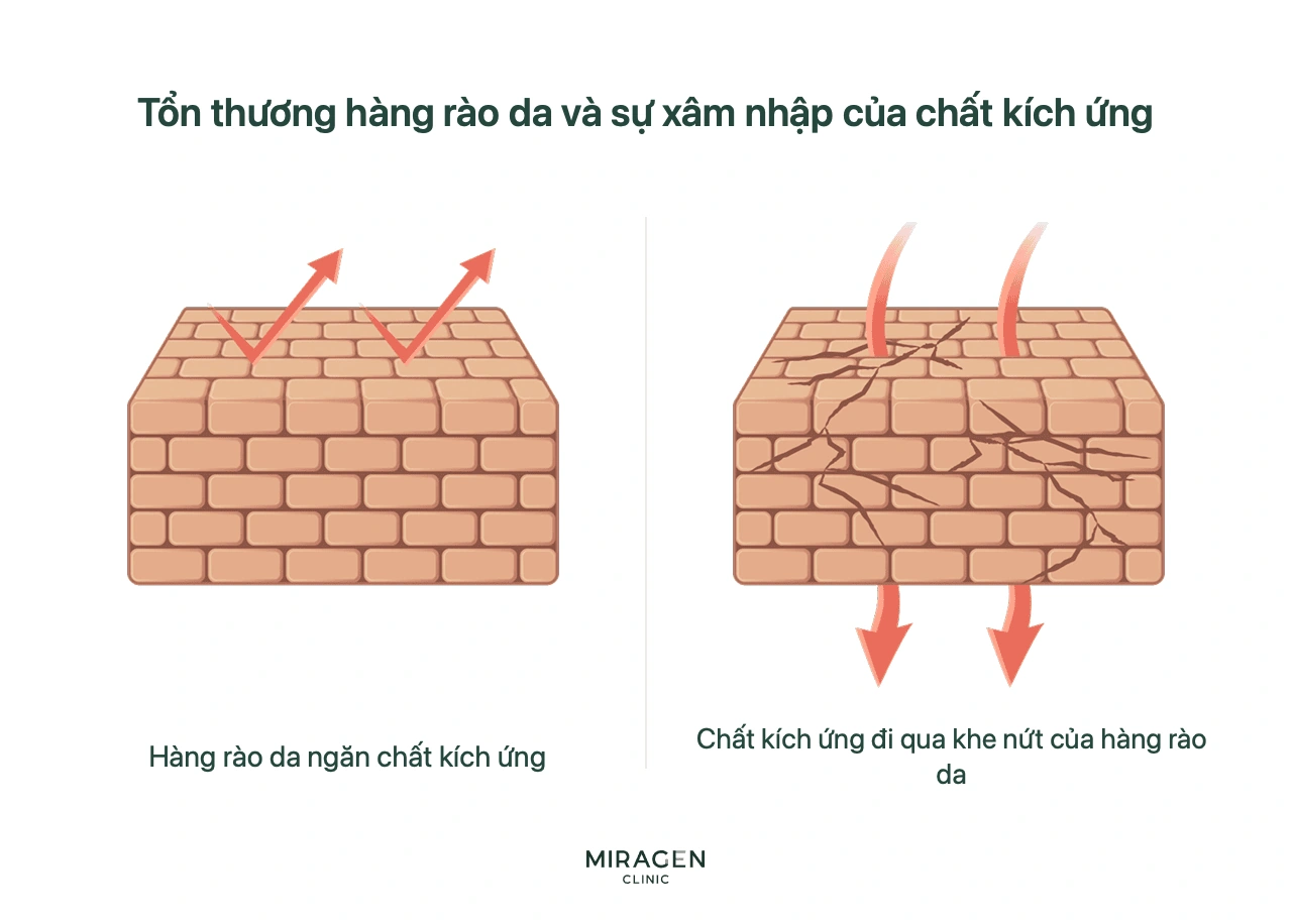 Hình ví von hàng rào da như bức tường gạch: da bình thường chặn kích thích bên ngoài, còn các khe hở của da tổn thương để chúng xâm nhập