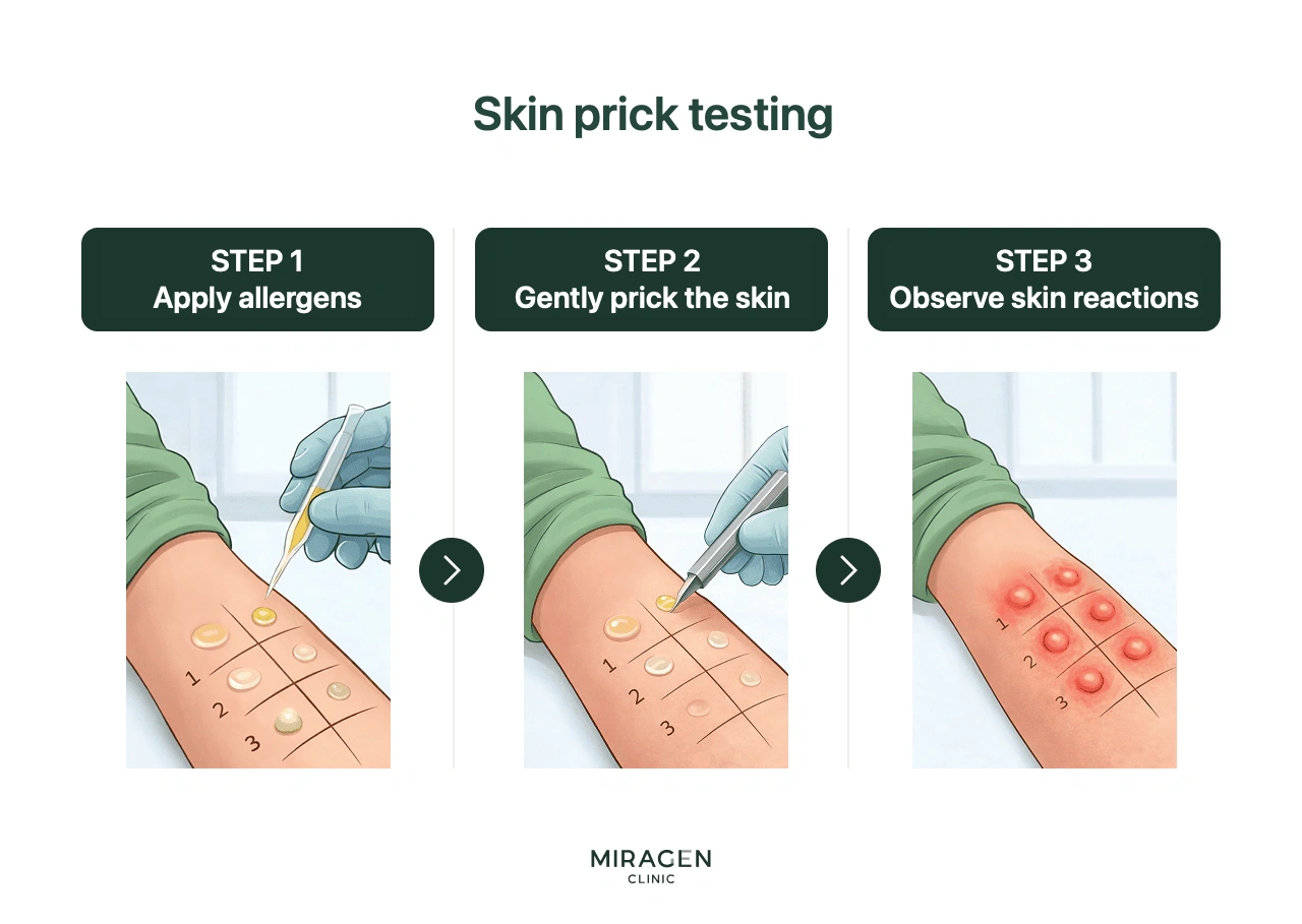 Infographic showing the process of the skin prick test, which was used instead of the MAST blood test in the past