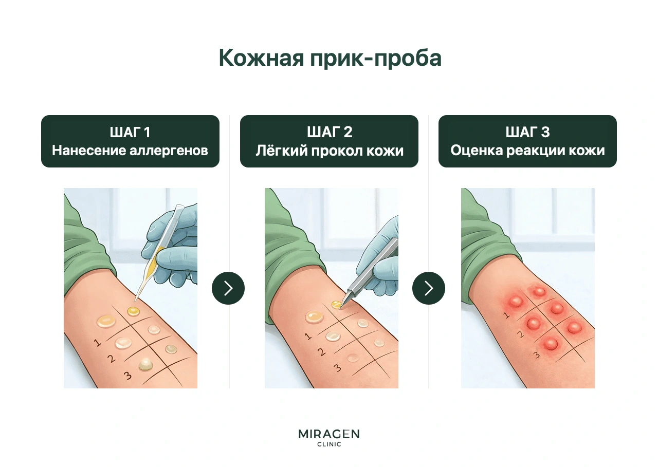Инфографика показывает ход кожной прик-пробы, применявшейся как альтернатива анализу крови MAST