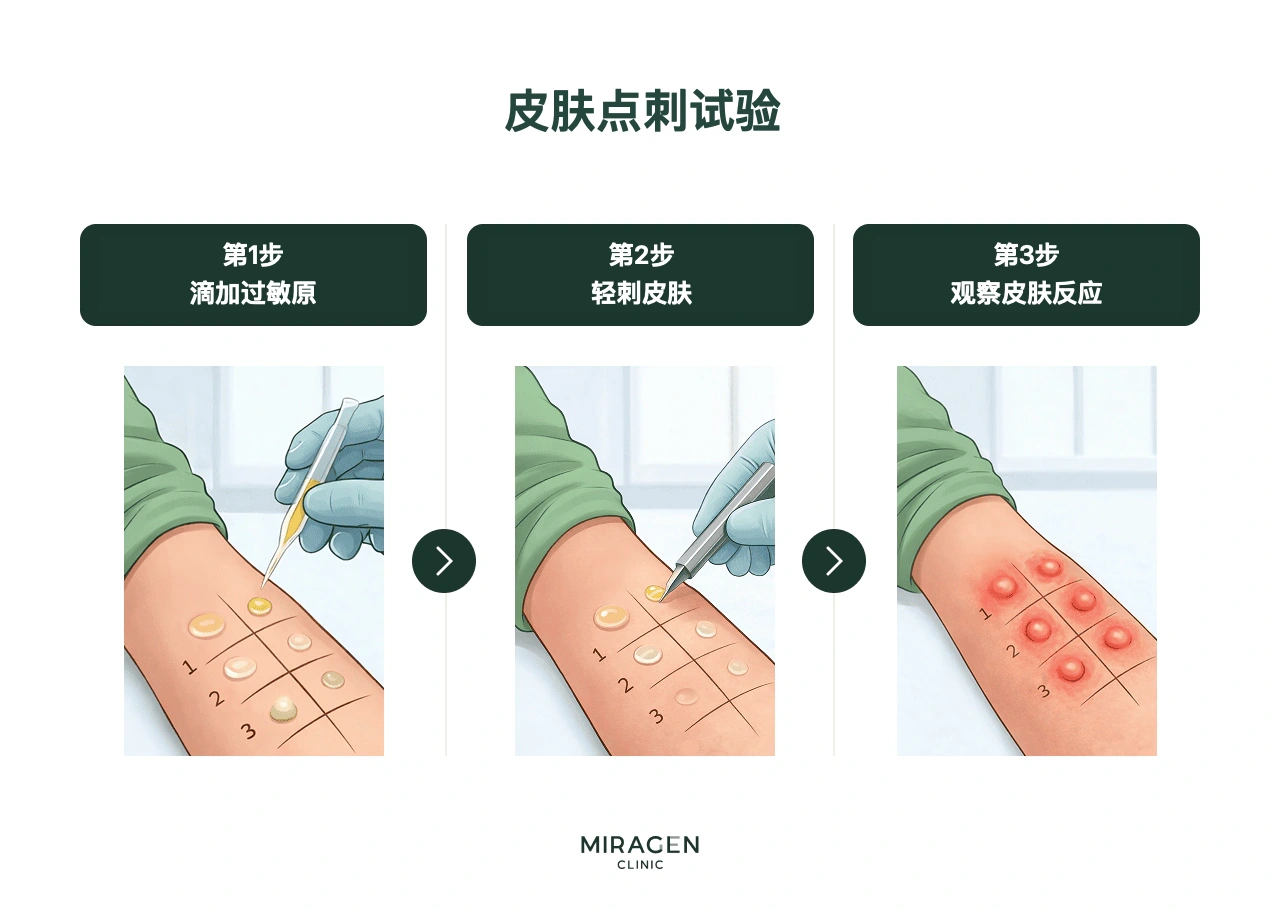 信息图展示过去常用于替代 MAST 血液检查的皮肤点刺试验过程