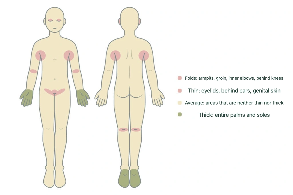 An infographic showing differences in topical steroid ointment absorption by body area—absorption is high on the eyelids and genitals and low on the palms and soles—explaining that you should choose different ointment classes depending on the area