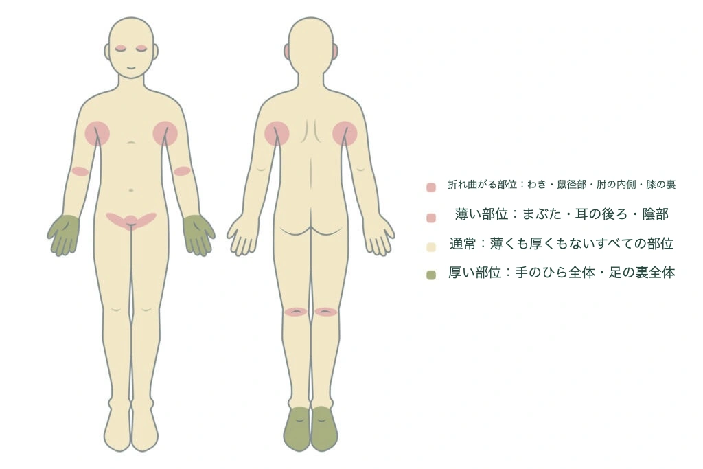 人体部位別ステロイド軟膏吸収率の差を示すインフォグラフィックで、まぶたと生殖器は吸収率が高く、手のひらと足の裏は低いため、部位によって軟膏の等級を変えて選択する必要があることを説明