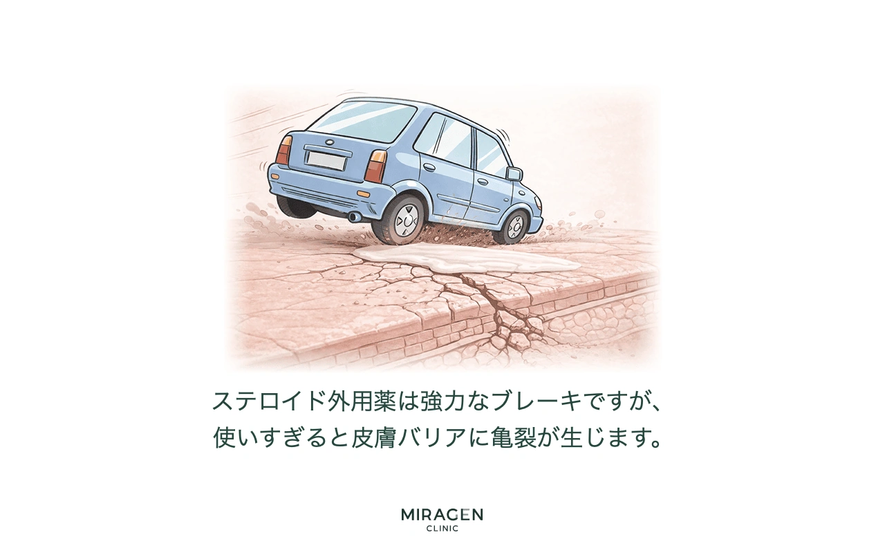 ステロイド外用剤を必要な苔癬化部位にのみ正確に使用すべきであるという意味の緊急ブレーキインフォグラフィック
