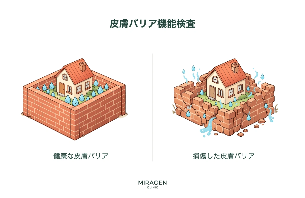 皮膚表面から蒸散する水分量(TEWL、経皮水分蒸散量)を測定し、皮膚バリア損傷度を数値で確認する皮膚バリア機能検査インフォグラフィック