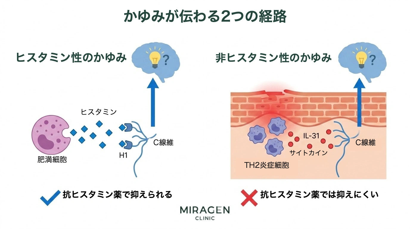 かゆみの伝達経路を比較したイラスト。左は肥満細胞からのヒスタミン放出がC線維神経を刺激するヒスタミン性経路で、抗ヒスタミンで調整される。右はIL-31などの炎症シグナル物質が感覚神経を直接刺激する非ヒスタミン性経路で、抗ヒスタミンでは遮断されにくい構造を説明