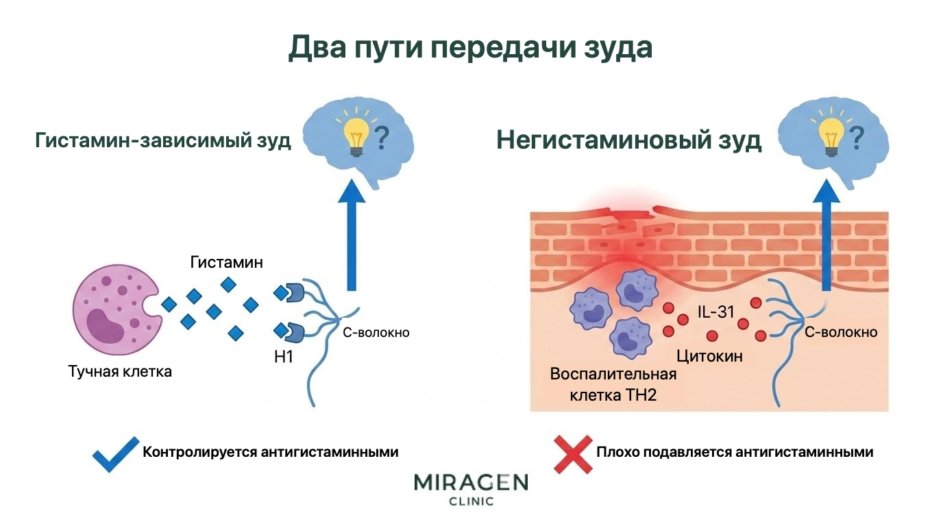 Иллюстрация сравнивает два пути зуда: слева гистамин тучных клеток стимулирует нервные C-волокна и действие можно ослабить антигистаминным препаратом, справа IL-31 непосредственно стимулирует чувствительные нервы и плохо блокируется этим препаратом