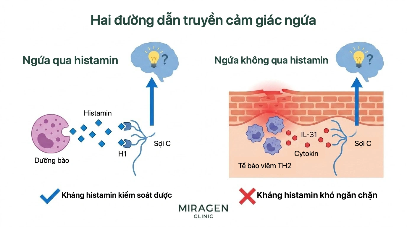 Hình so sánh đường gây ngứa do histamine từ tế bào mast kích thích sợi thần kinh C, có thể được kiểm soát bằng thuốc kháng histamine, với đường không do histamine như IL-31 kích thích trực tiếp thần kinh cảm giác