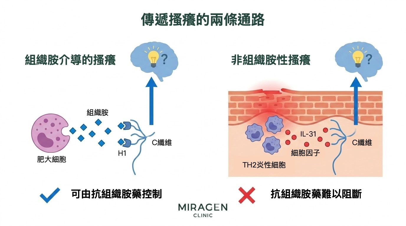 比較搔癢傳導途徑的插圖。左側為肥大細胞釋放組織胺，刺激 C 纖維神經的組織胺性途徑，可用抗組織胺藥調節；右側為 IL-31 等發炎訊號物質直接刺激感覺神經的非組織胺性途徑，抗組織胺藥難以阻斷