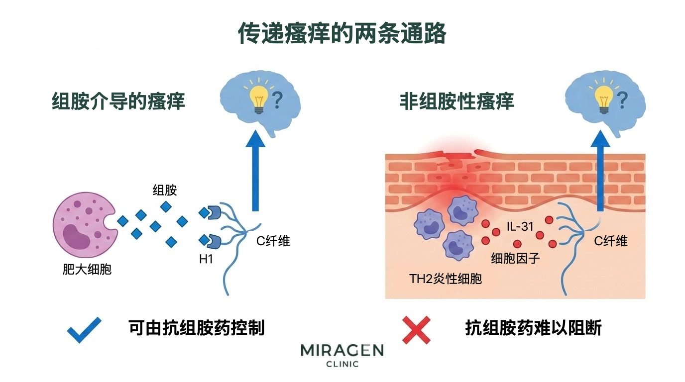 比较瘙痒传导途径的插图。左侧为肥大细胞释放组胺，刺激 C 纤维神经的组胺性途径，可用抗组胺药调节；右侧为 IL-31 等炎症信号物质直接刺激感觉神经的非组胺性途径，抗组胺药难以阻断