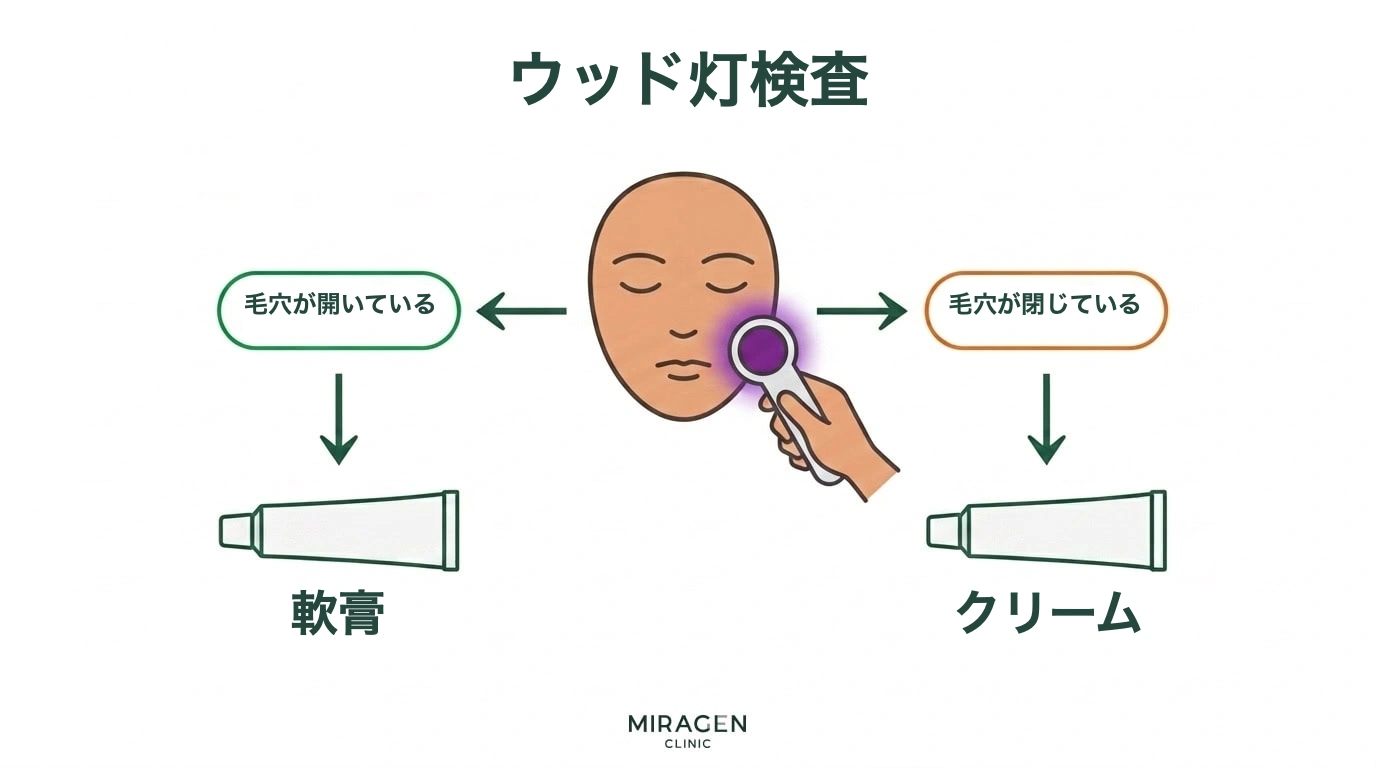 ウッド灯検査で毛穴の状態を確認した後、毛穴が開いている場合は軟膏、閉塞している場合はクリームを選択する顔のアトピー軟膏処方フローチャート