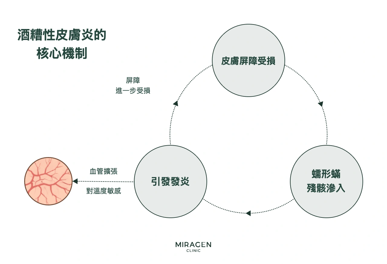 酒糟性皮膚炎核心機制的循環圖：皮膚屏障受損後蠕形蟎殘骸侵入並引發發炎，發炎又再次損傷屏障，造成血管擴張與對溫度敏感的變化，呈現惡性循環的結構
