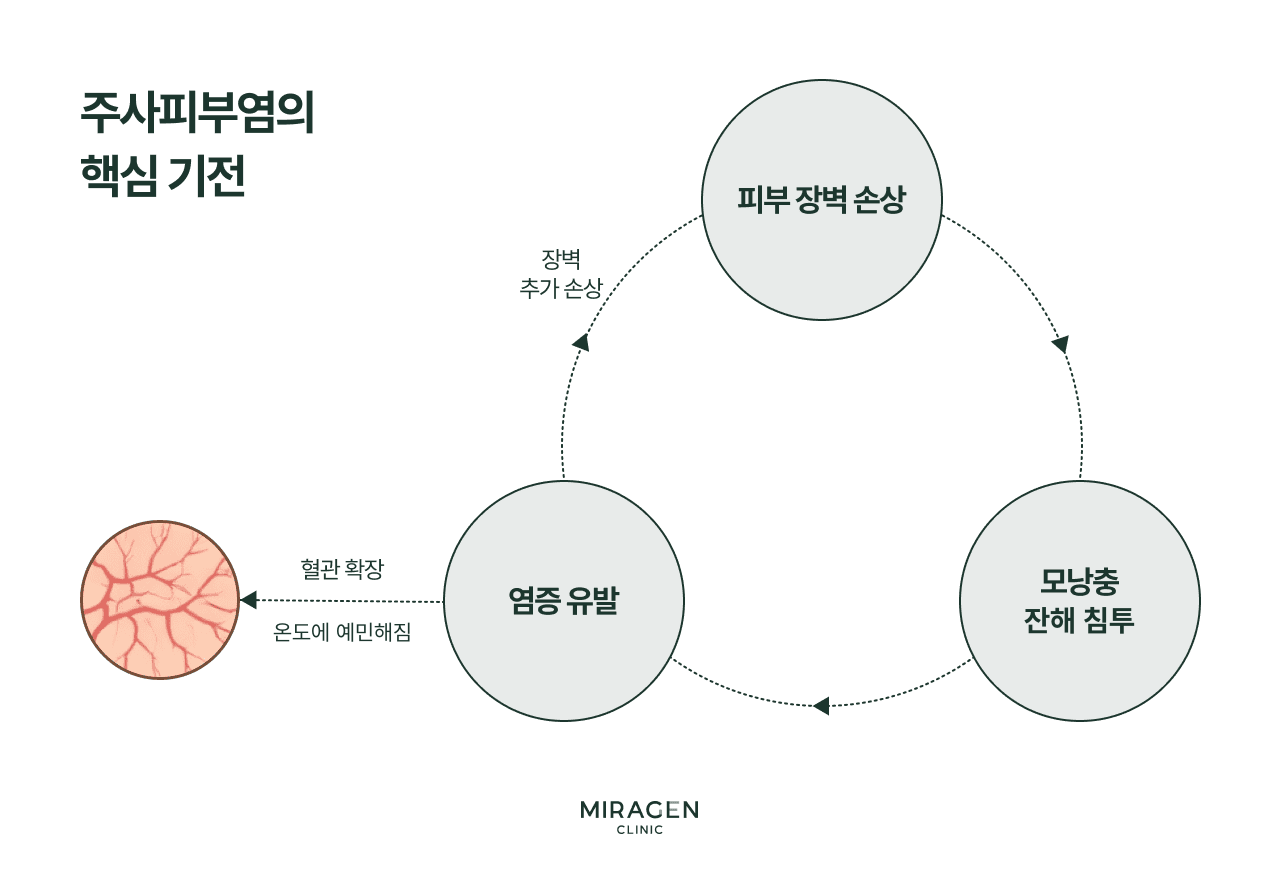 주사피부염 핵심 기전을 나타낸 순환 다이어그램으로 피부 장벽이 손상되면 모낭충 잔해가 침투하여 염증이 유발되고, 염증이 장벽을 다시 손상시키며 혈관 확장과 온도에 예민해지는 변화를 일으키는 악순환 구조를 보여줍니다