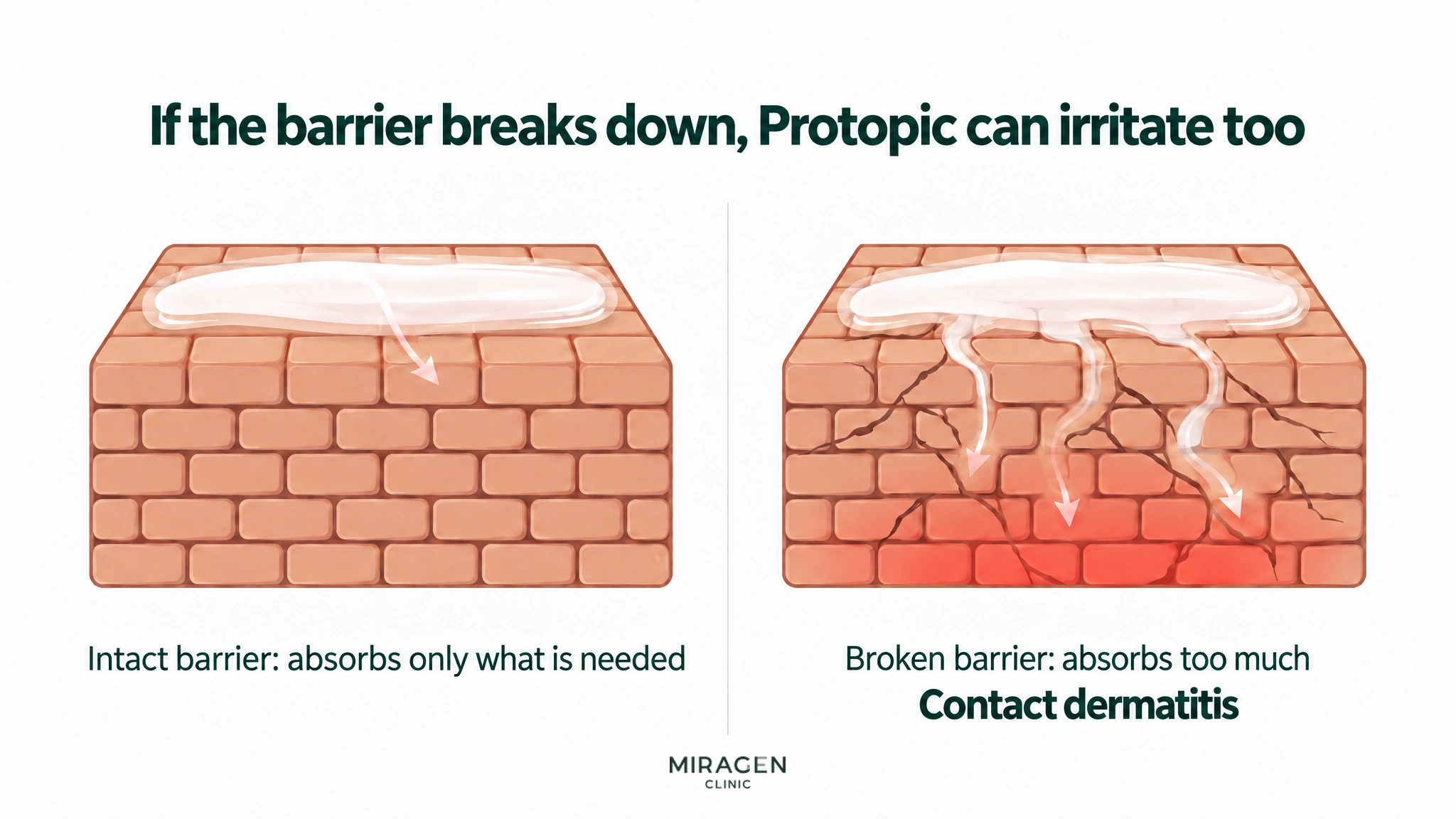 A two-panel comparison: on an intact brick-wall barrier the ointment soaks in only a little, while on a cracked barrier it soaks in deeply along the cracks and the area below turns red and hot